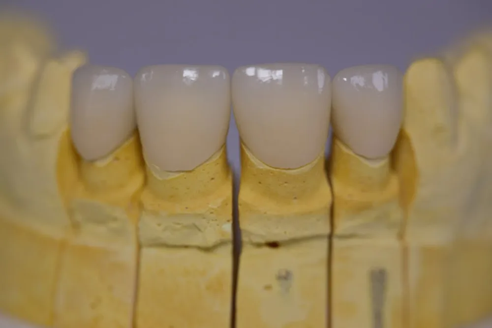 Rad u dentalnom laboratoriju