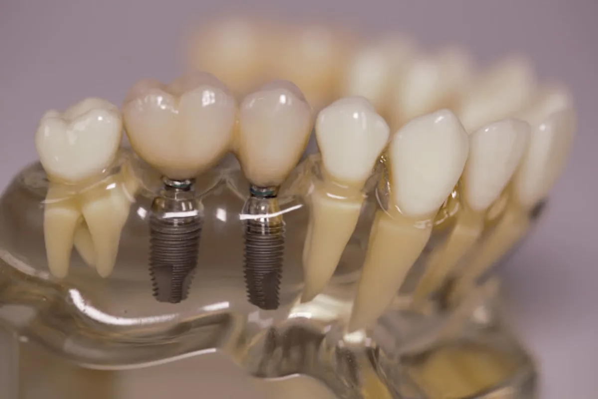 Dentalni zahvat u ordinaciji